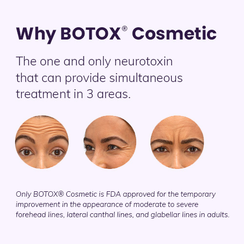 why botox cosmetic? the one and only neurotoxin that can provide simultaneous treatment in 3 areas.