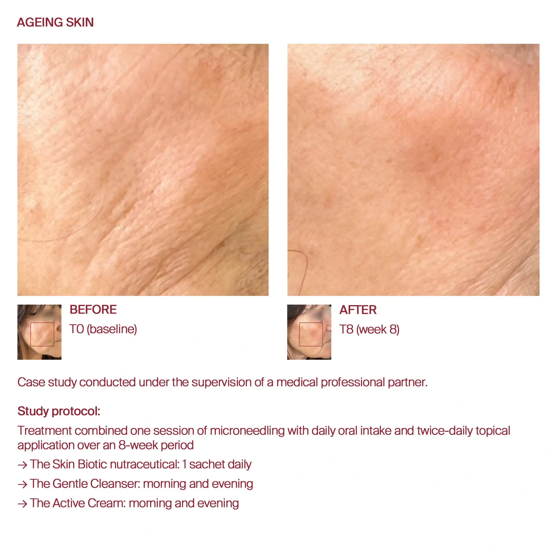 AWvi before and after ageing