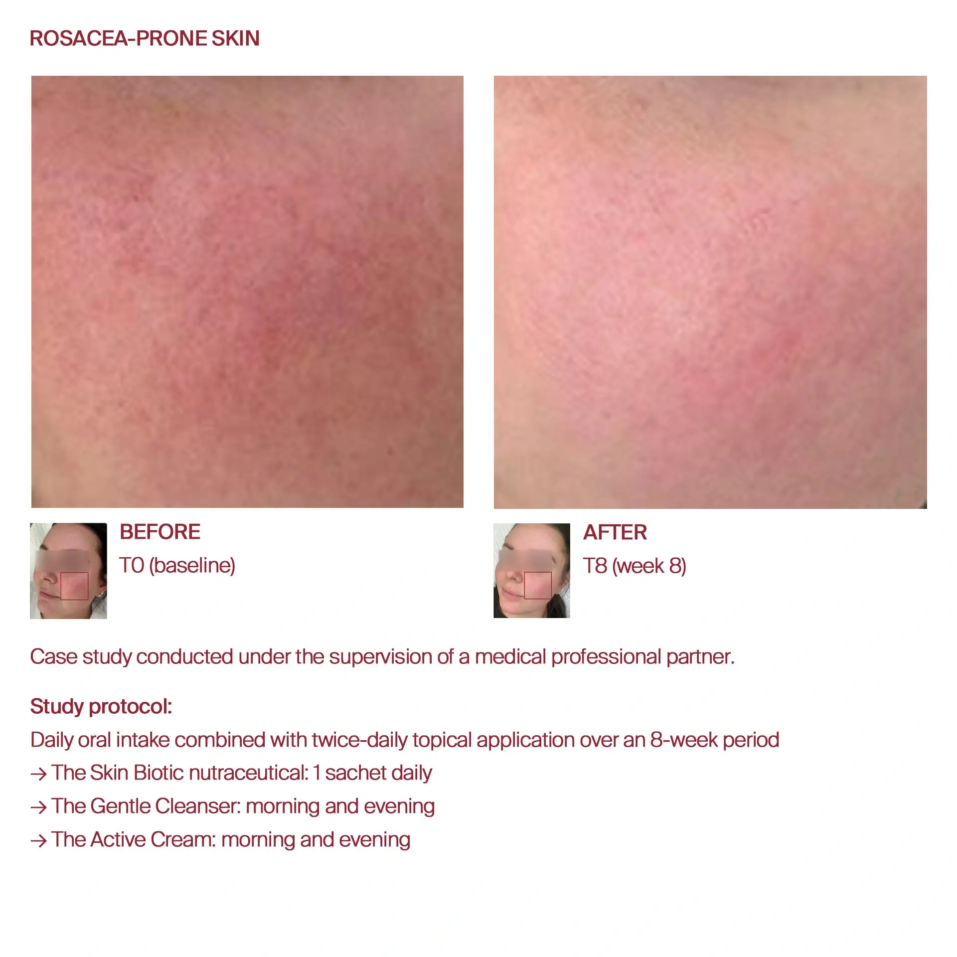 AWvi before and after sensitive