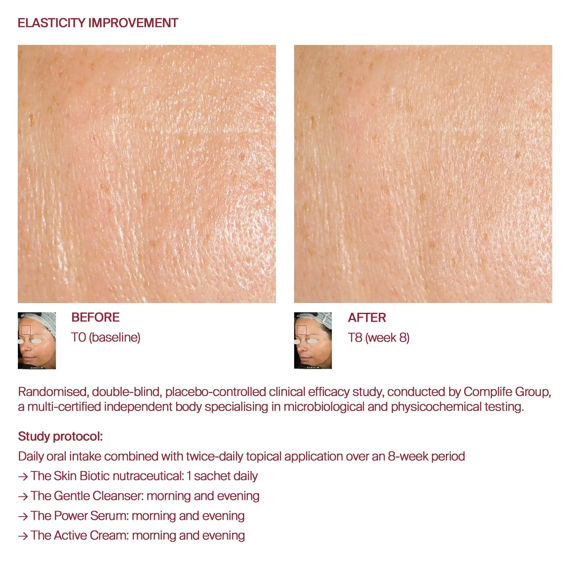 Awvi before and after elasticity