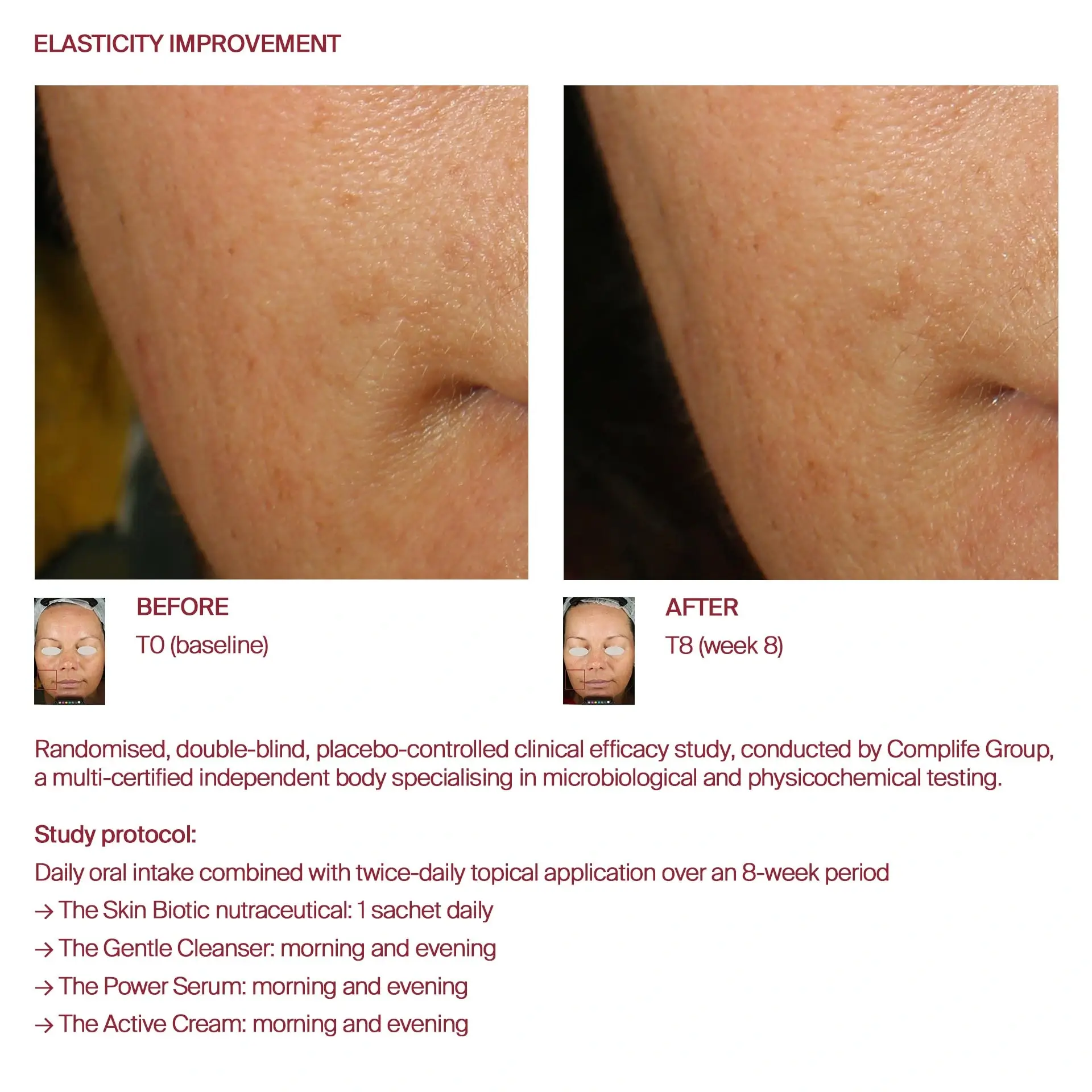 AWvi before and after elasticity