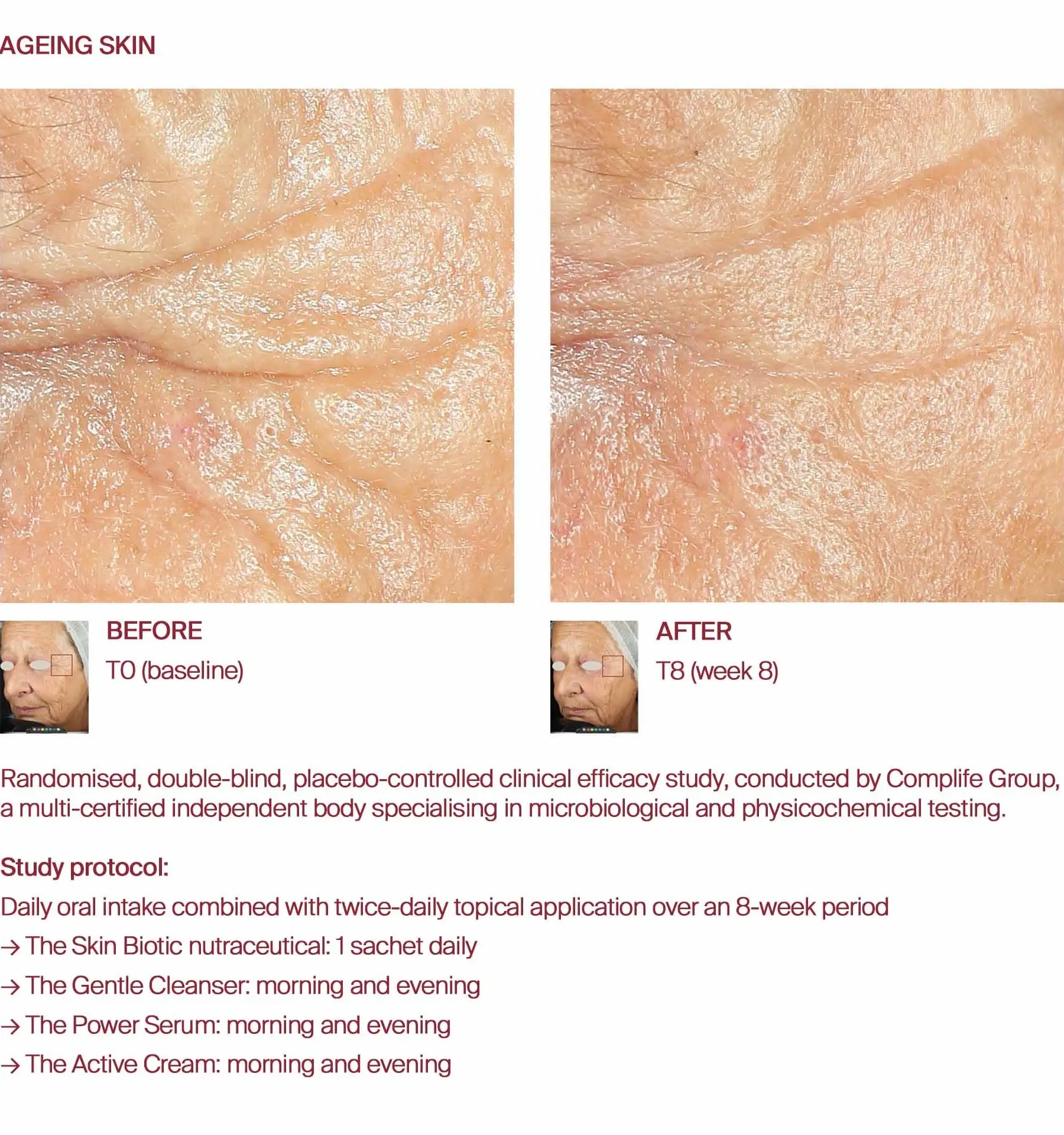 Ageing skin before and after