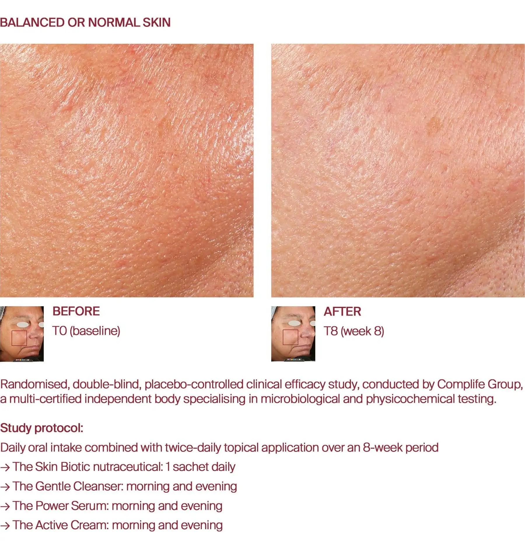 Balanced skin before and after