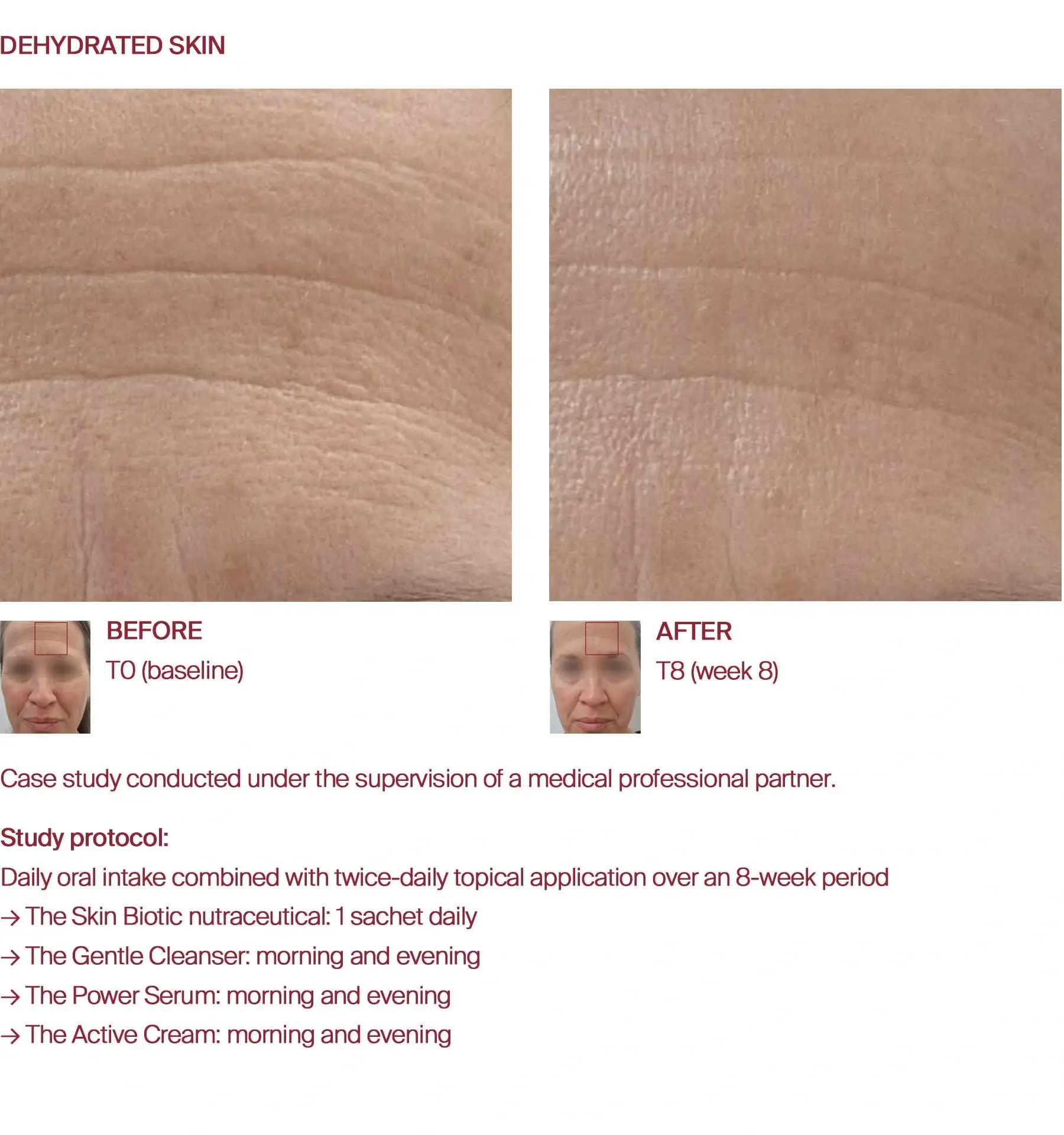 Dehydrated skin before and after