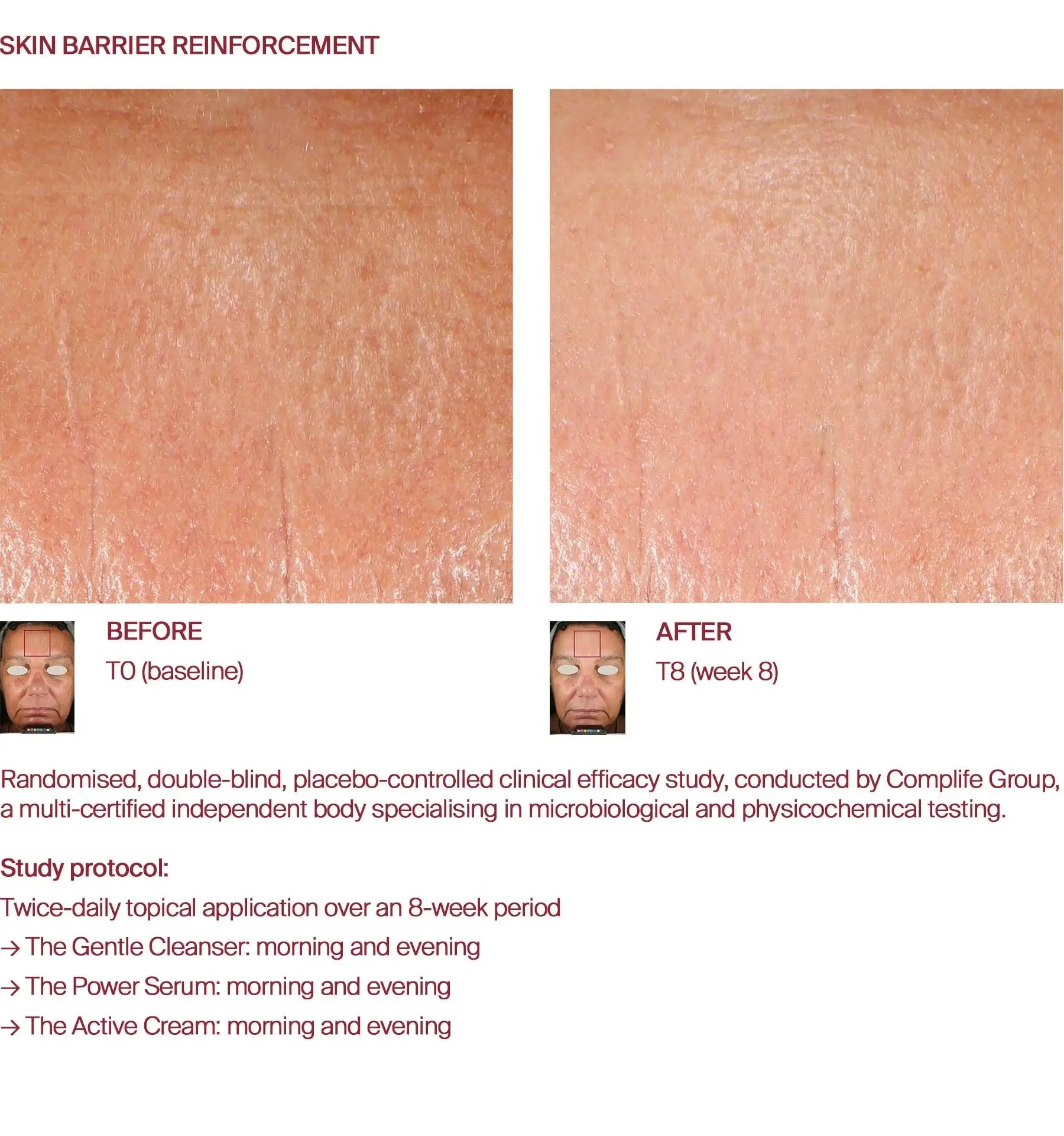 Skin barrier before and after