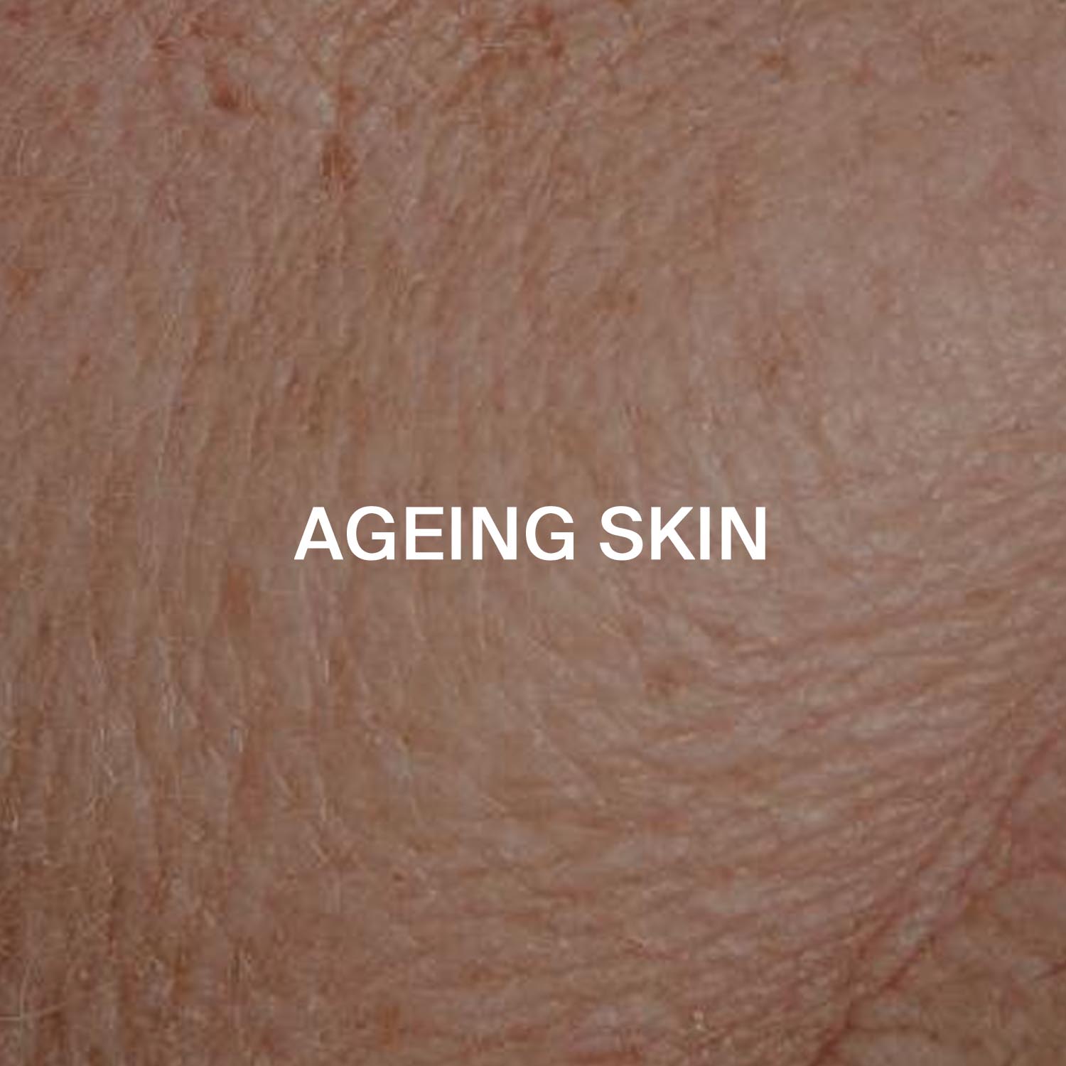 Ageing skin