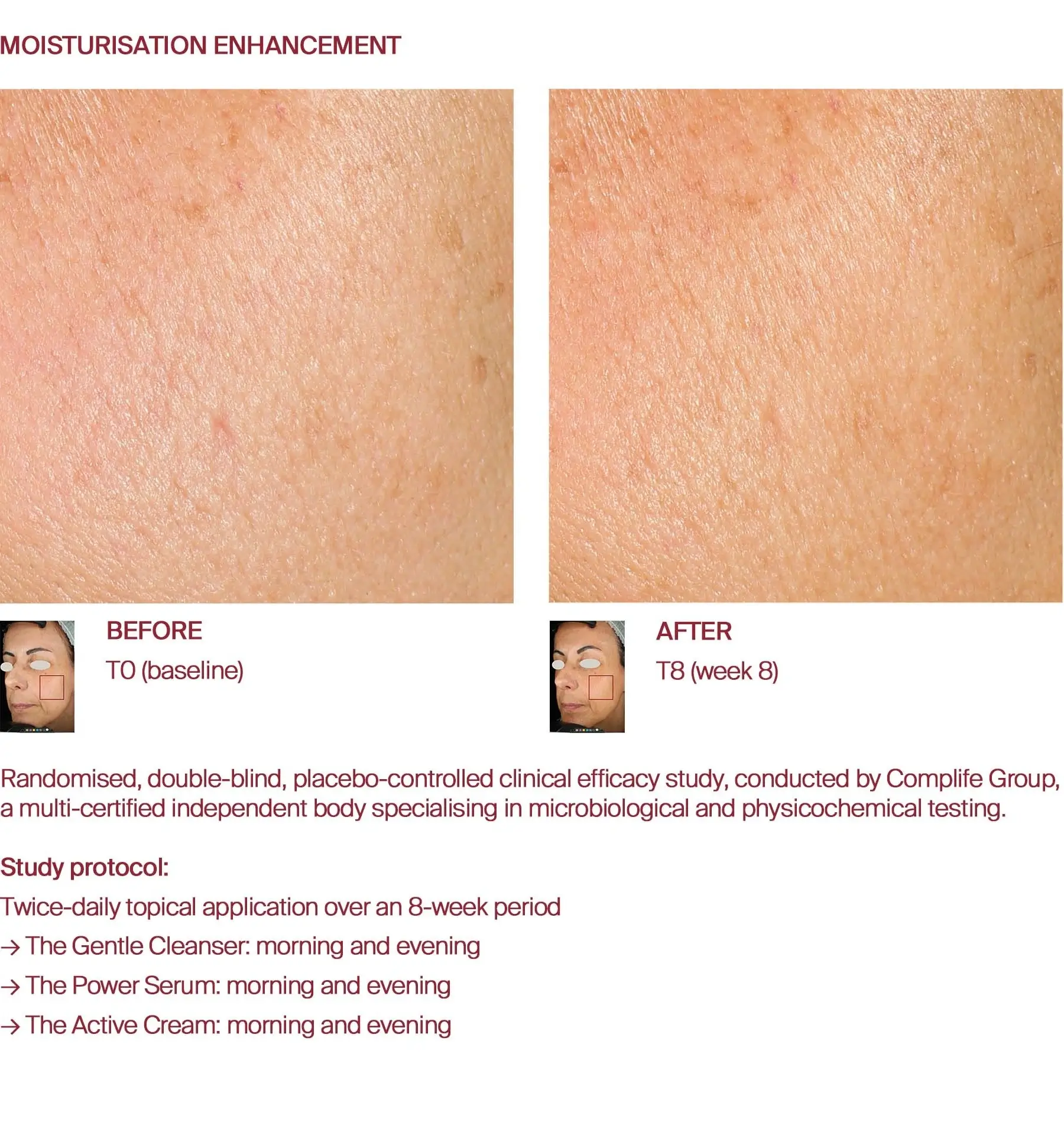 Moisturisation before and after