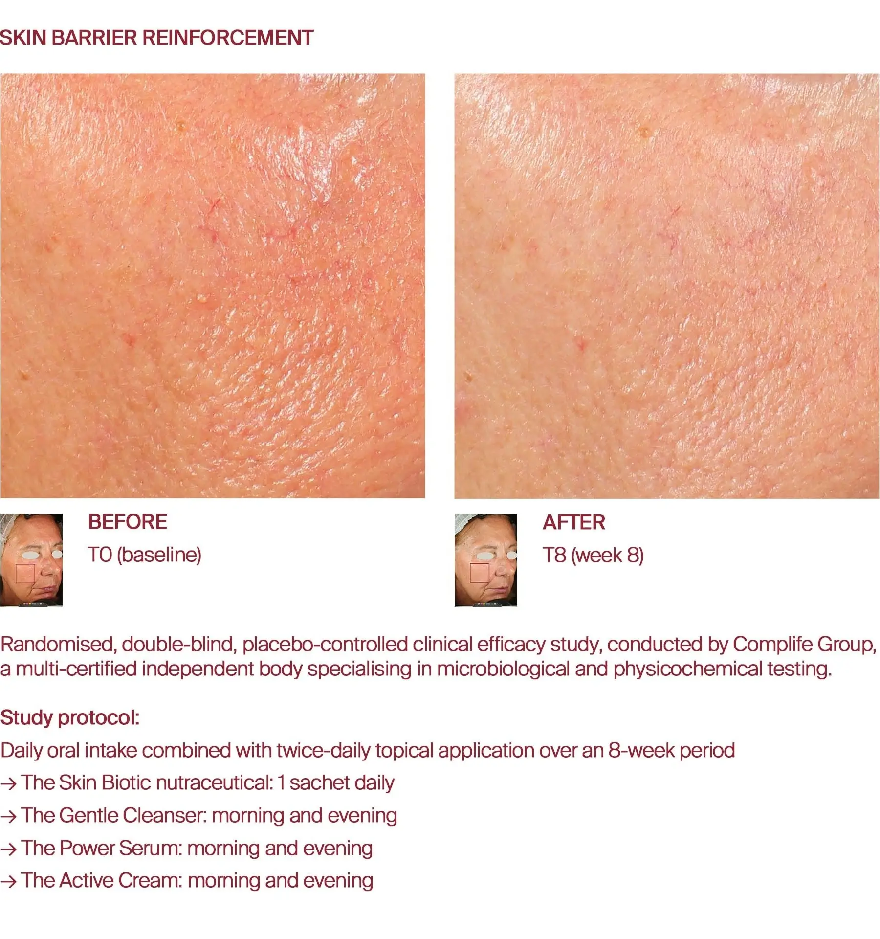 Skin barrier before and after