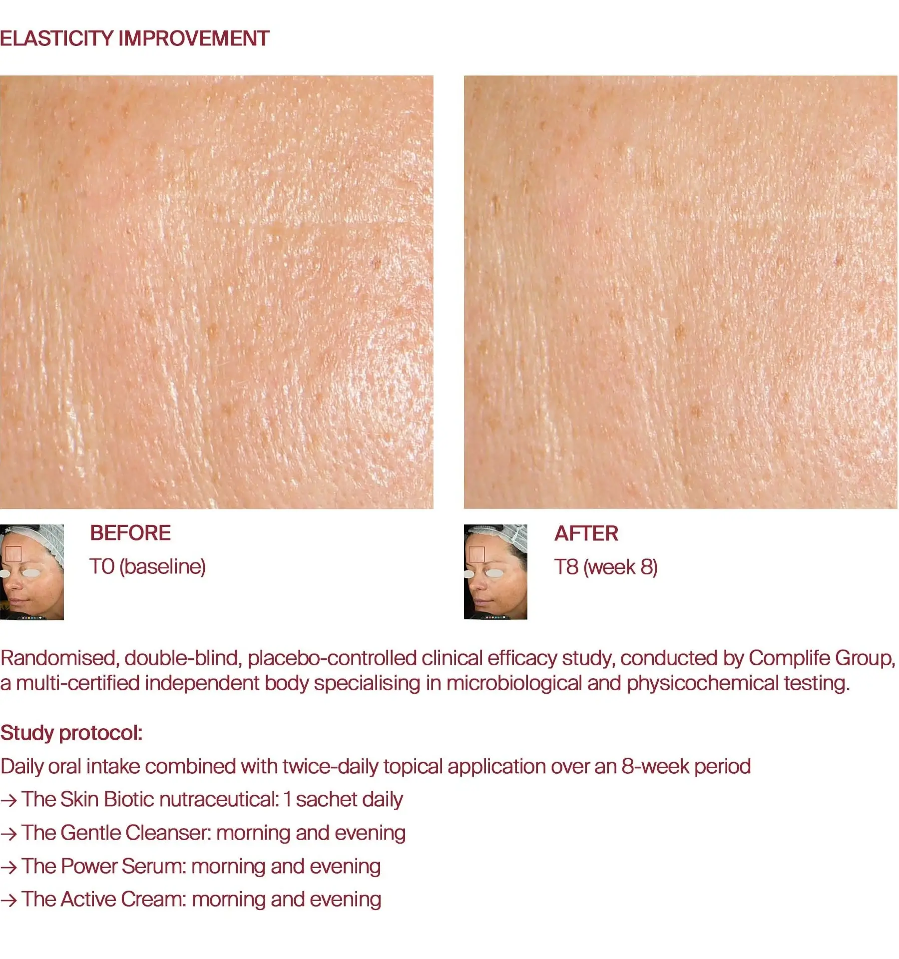 Elasticity before and after