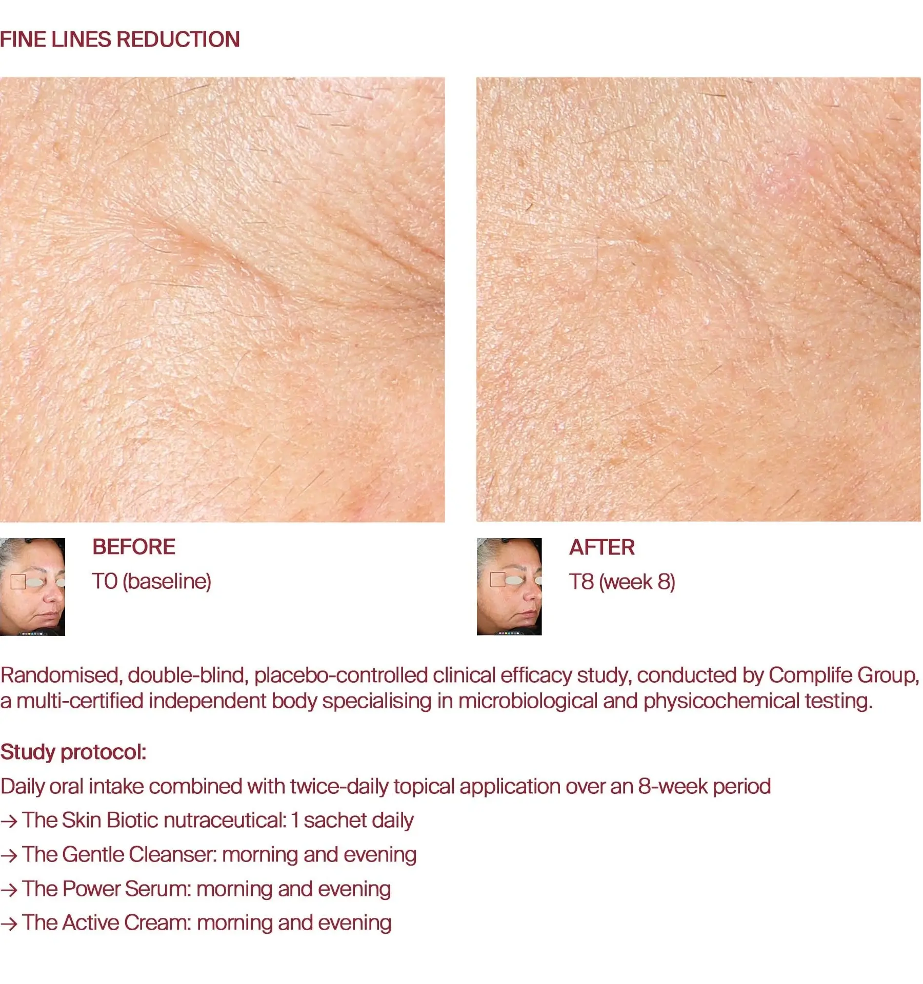 Fine lines before and after