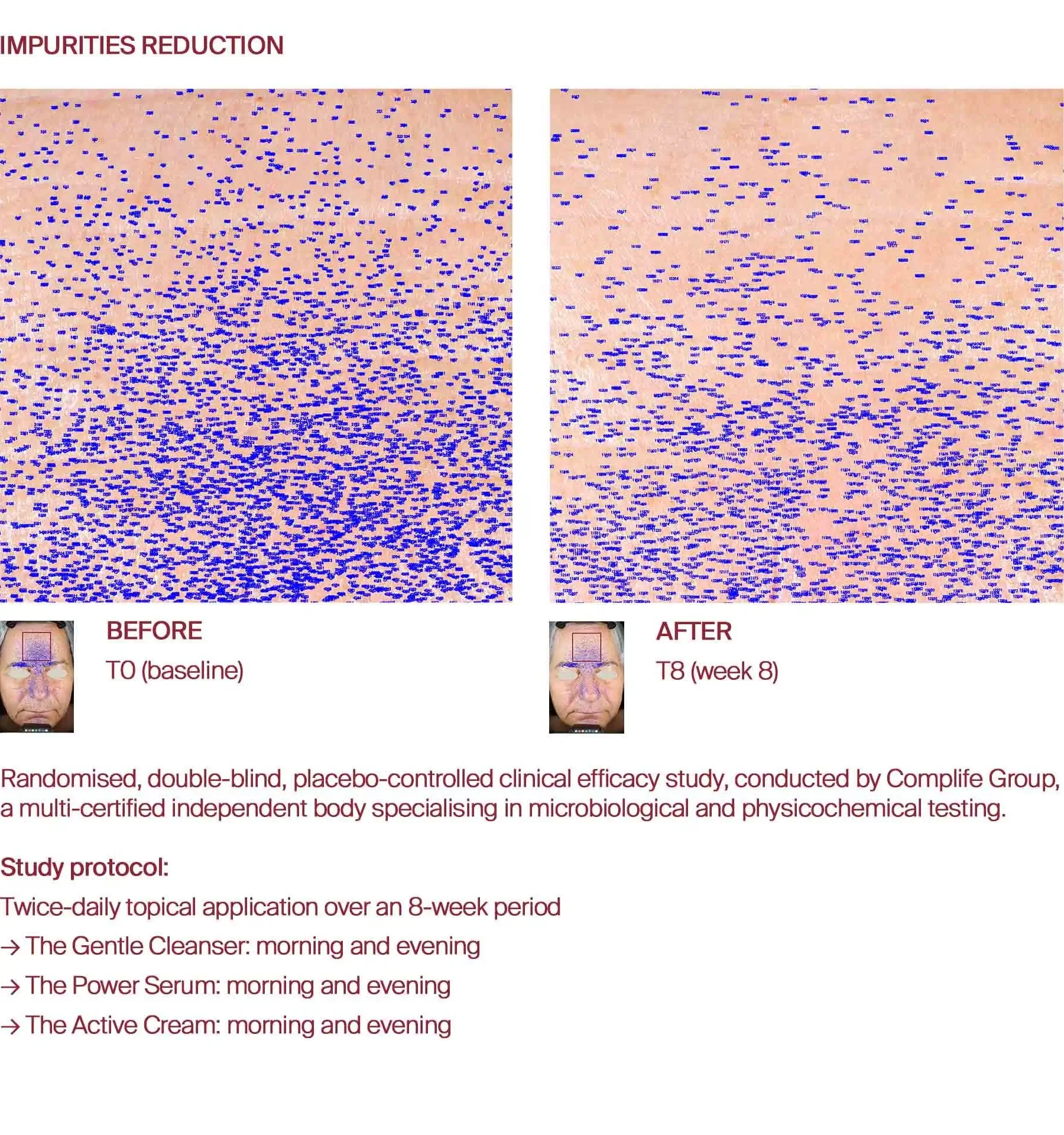 Impurities before and after
