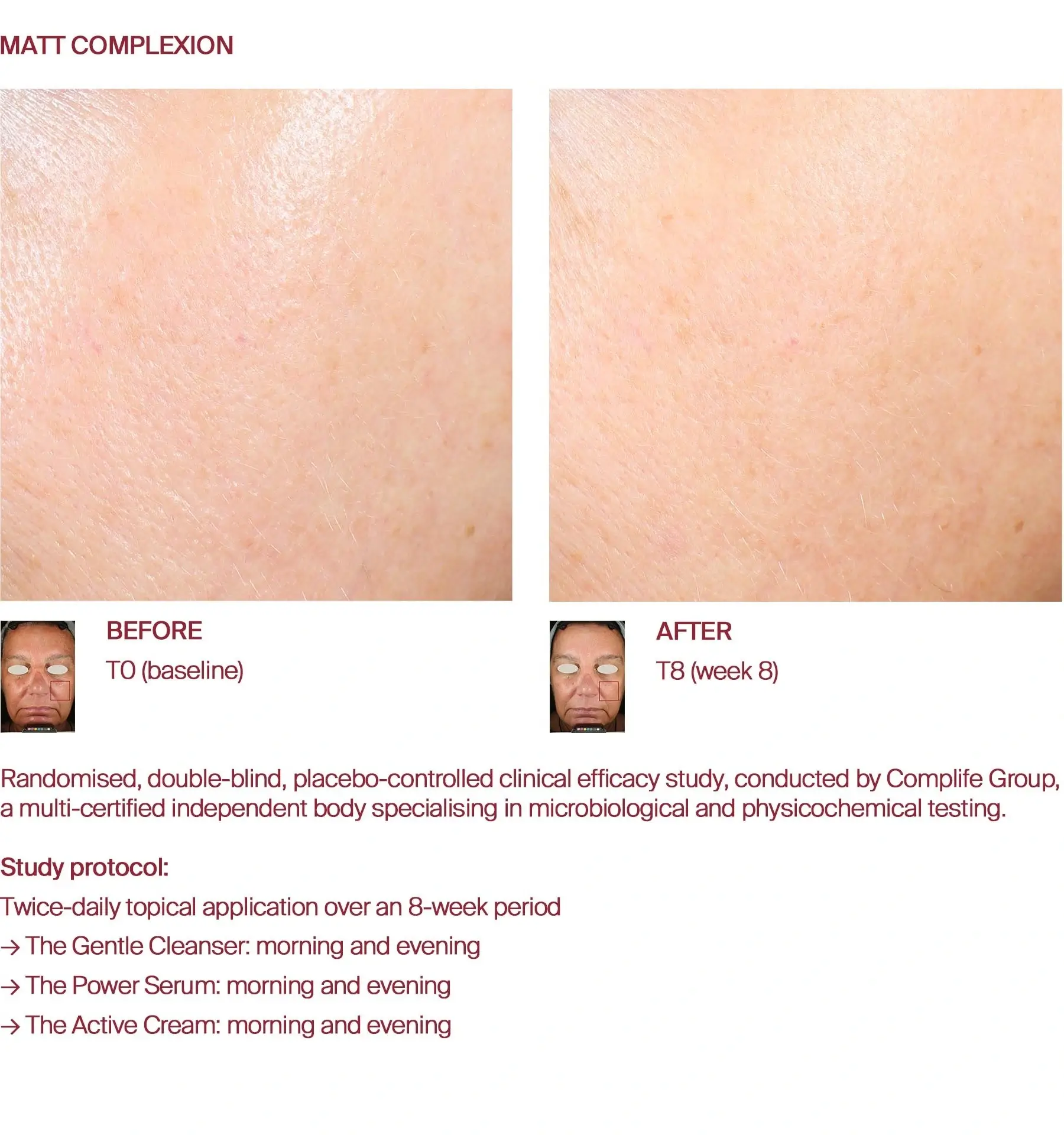 Matt complexion before and after