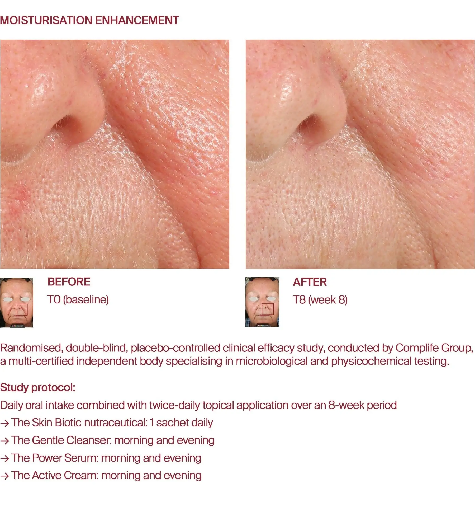 Moisturisation before and after