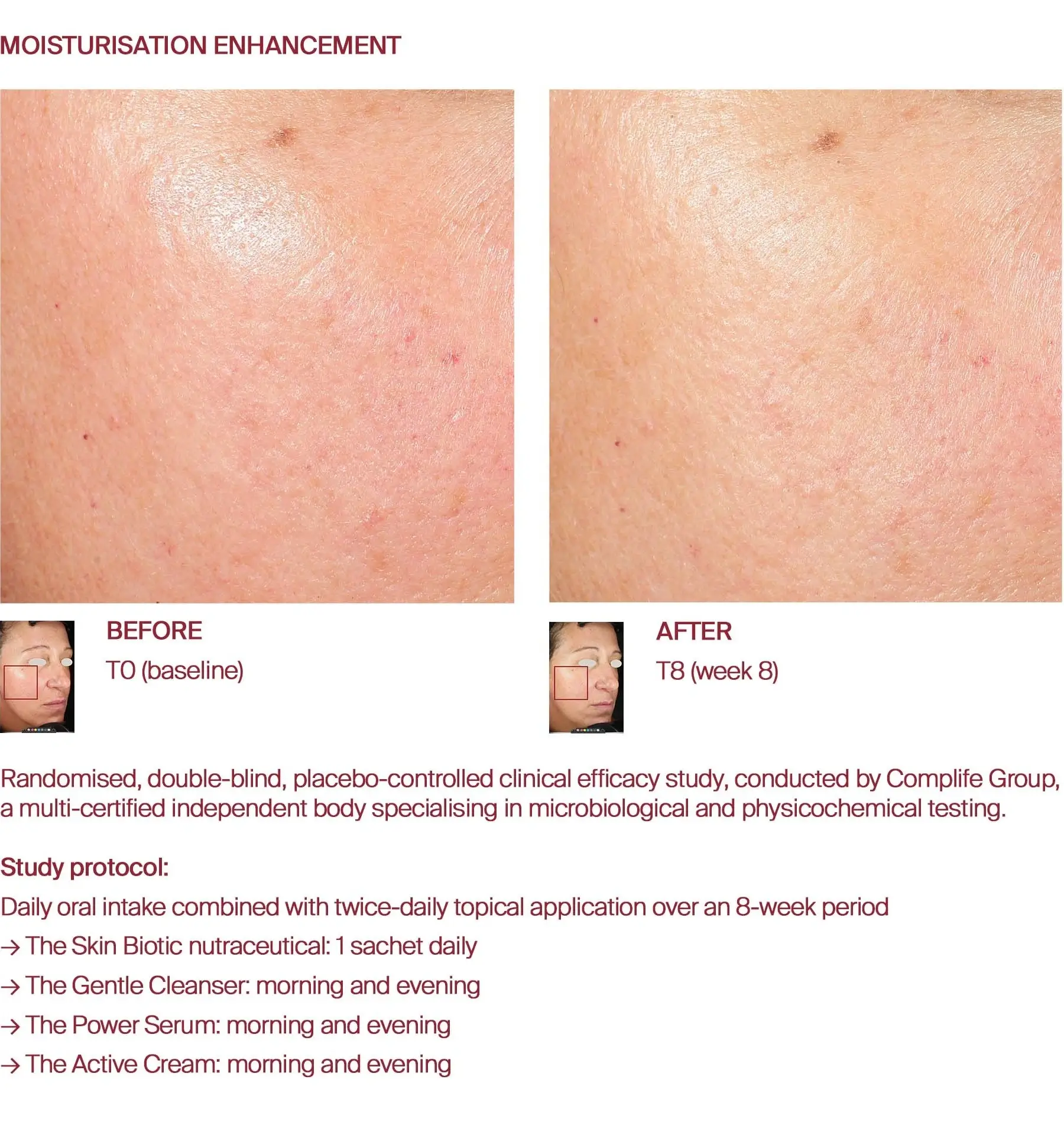 Moisturisation before and after