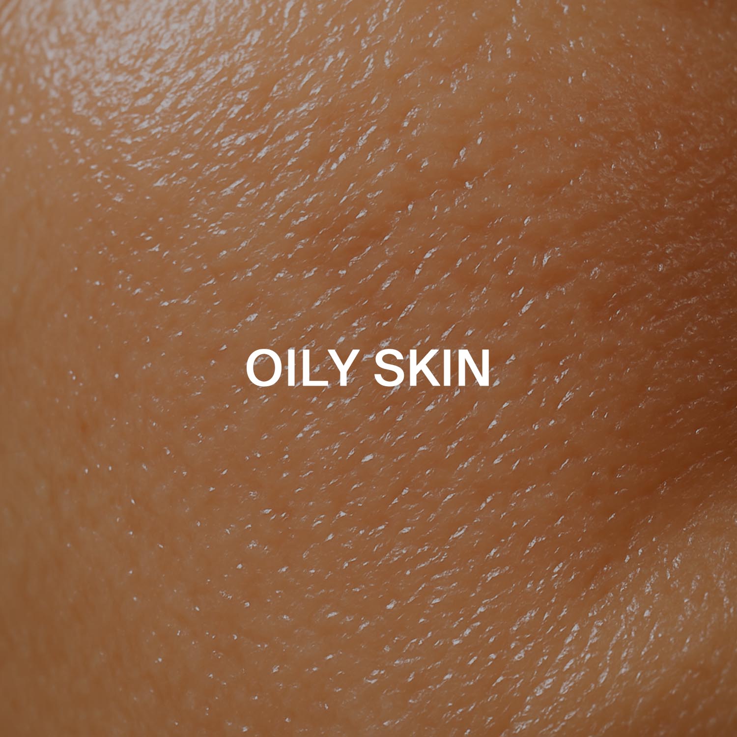 Oily skin