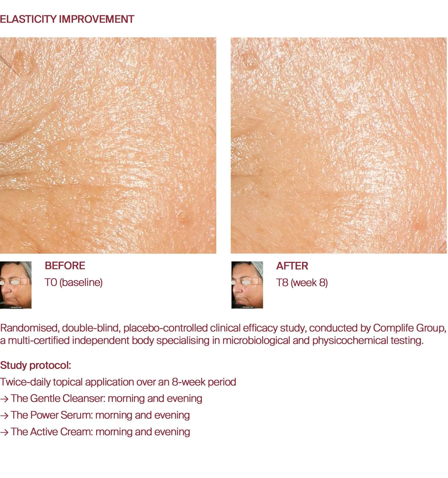 Elasticity improvement before and after