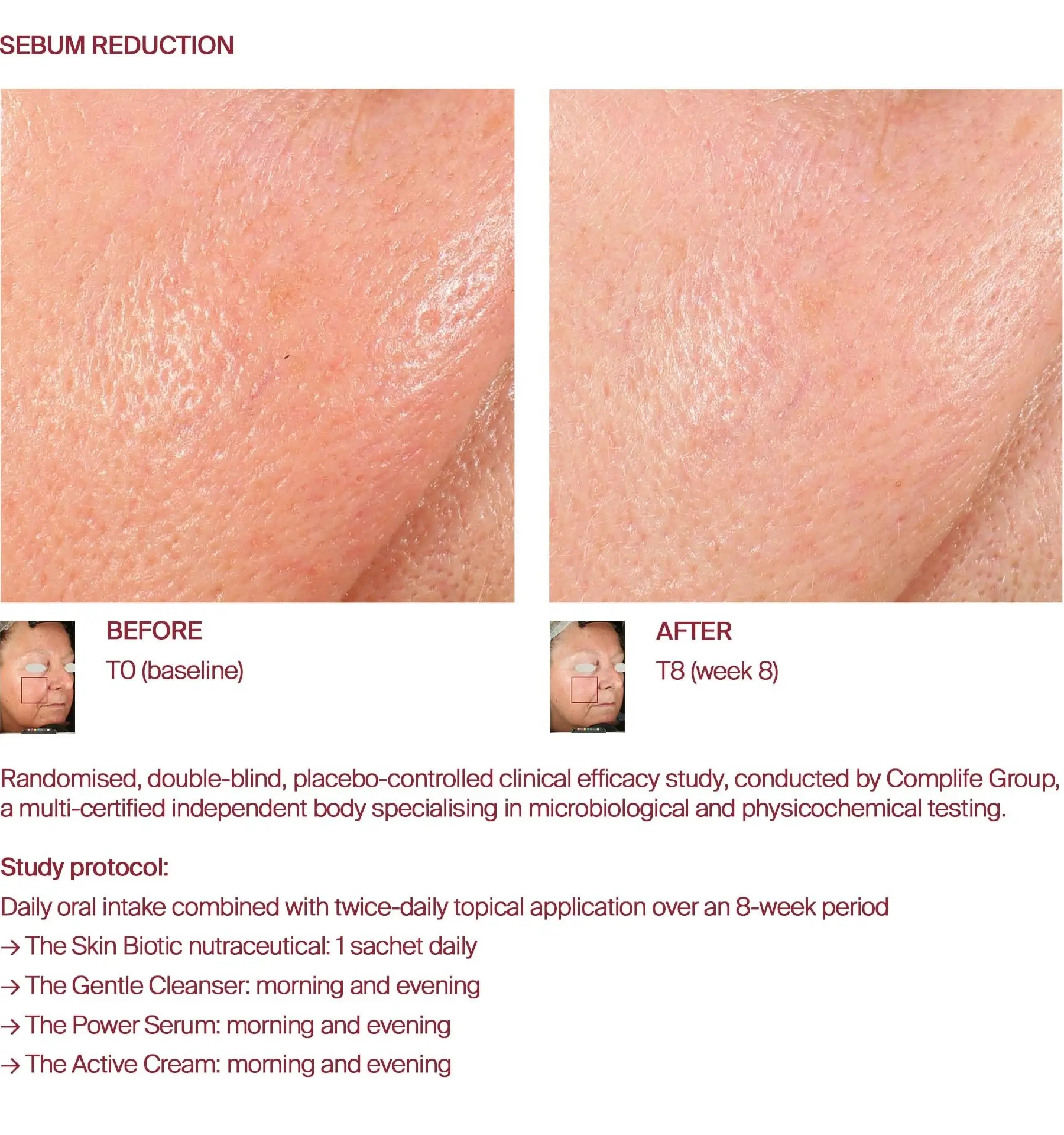 Sebum regulation before and after