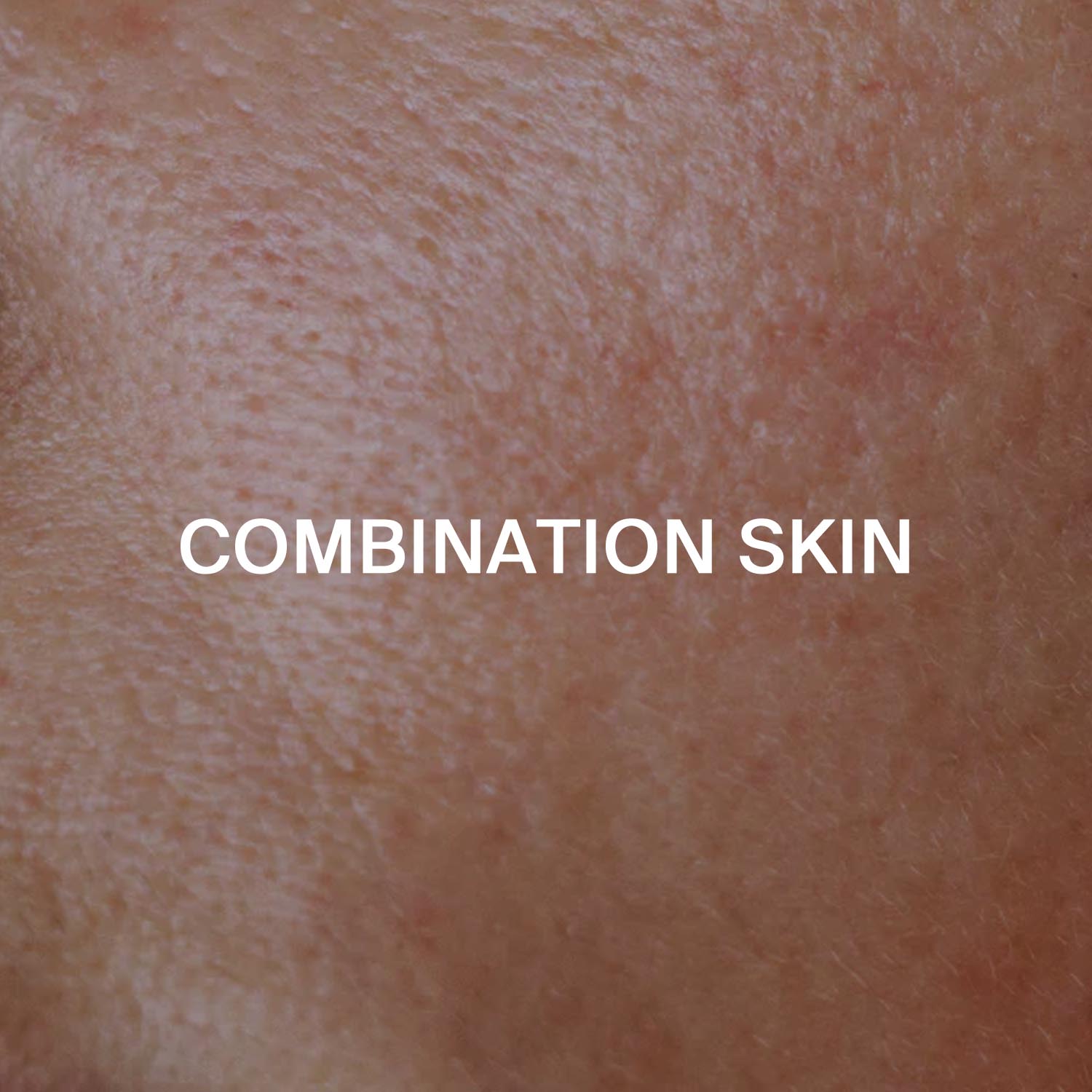 Combination skin
