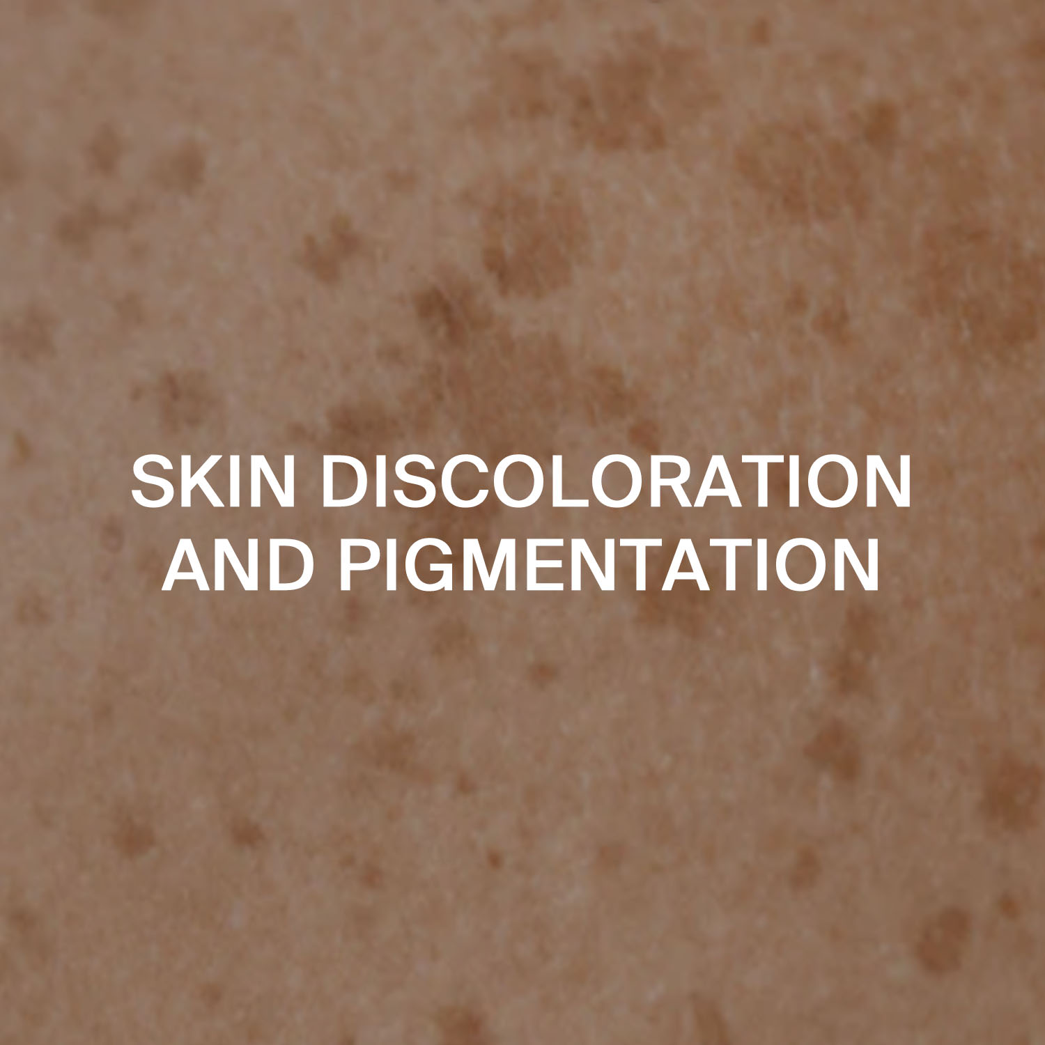 Skin Discolouration and Pigmentation