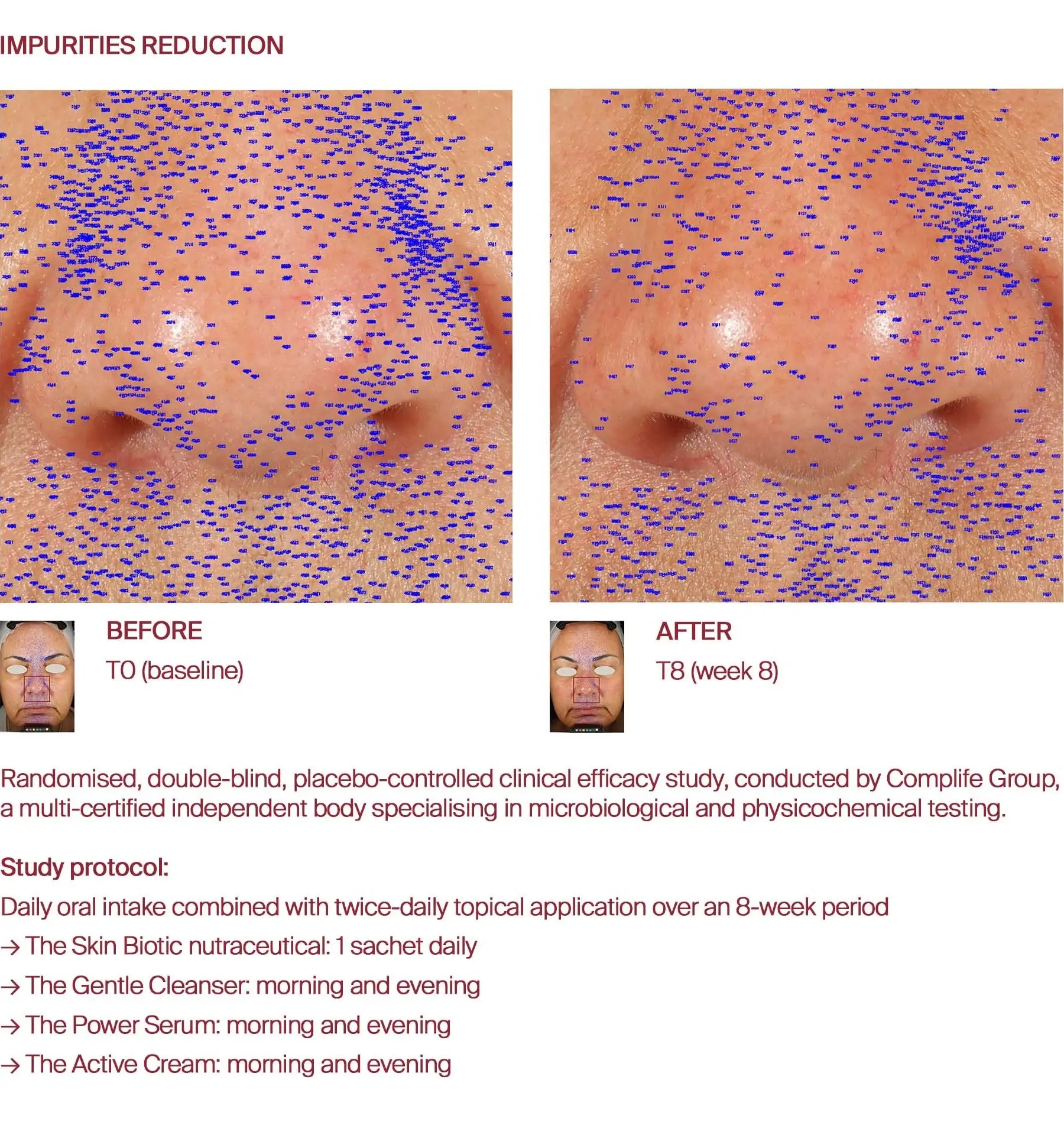 Impurities reduction before and after