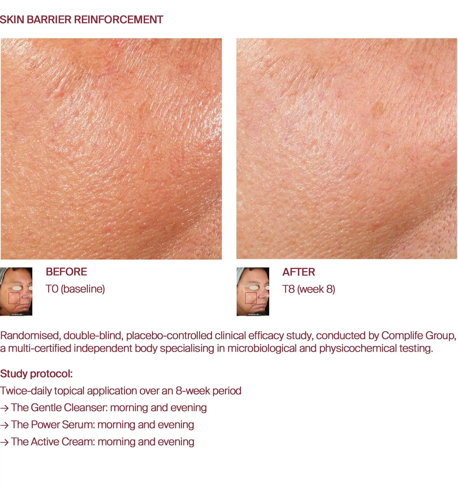 Skin barrier before and after