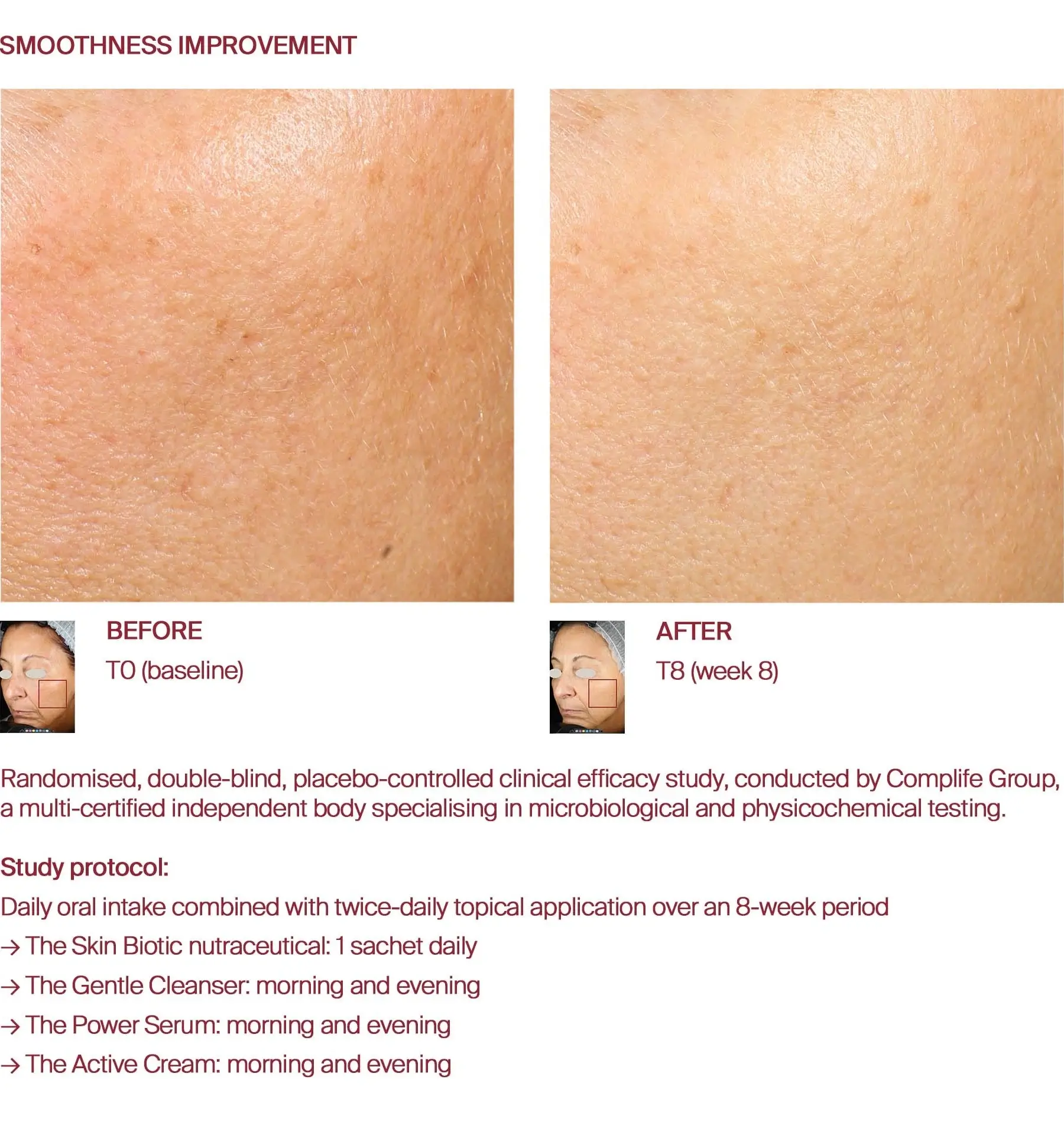 Smoothness before and after