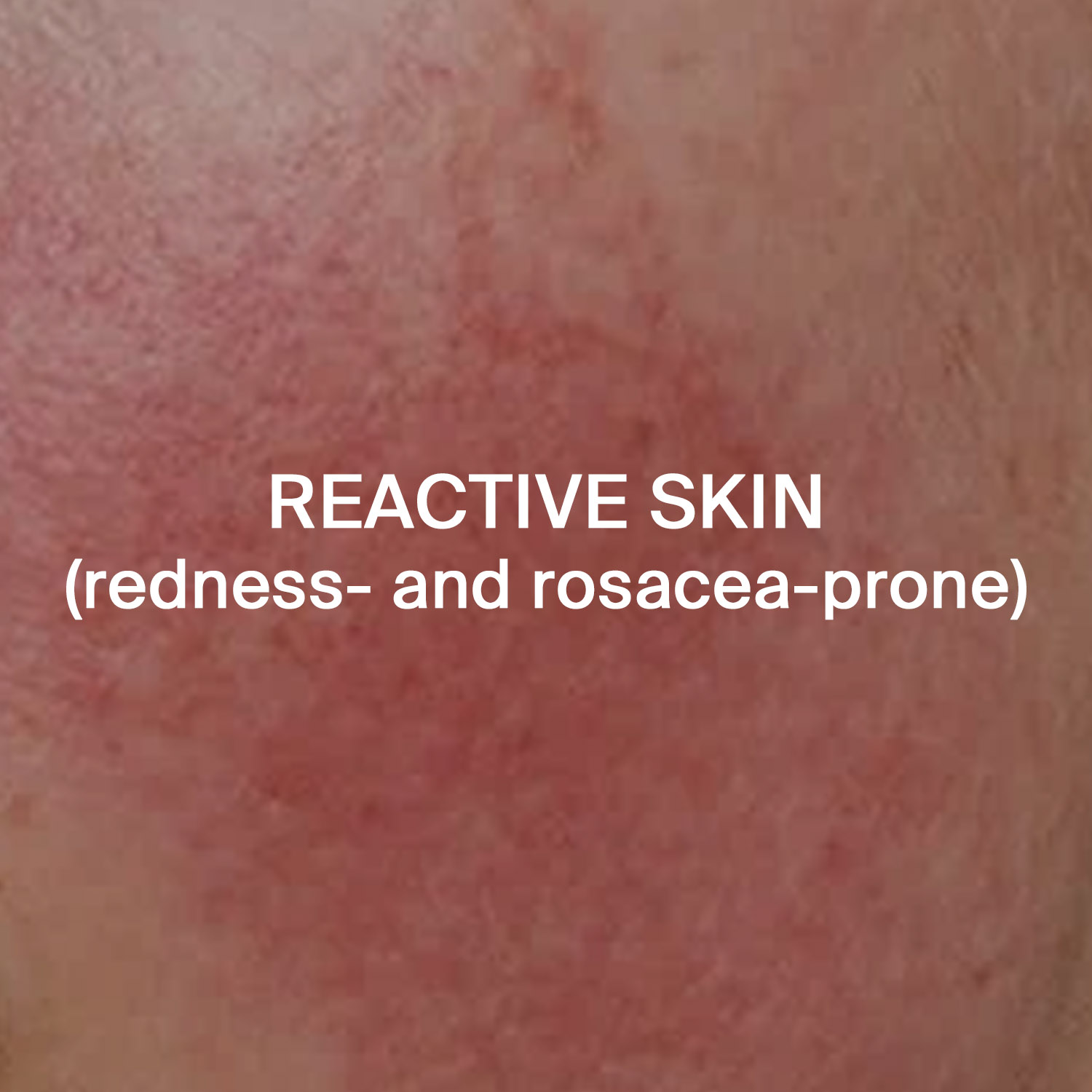 Reative skin