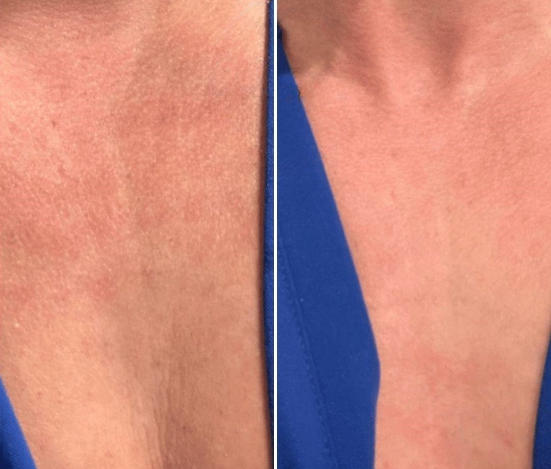 newest before and after