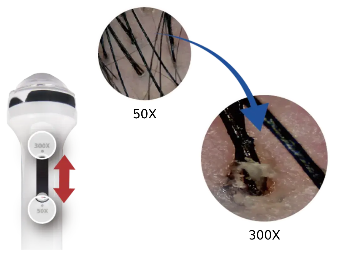 Diagram showing 50x to 300x magnification