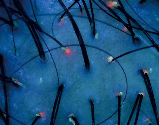 A scalp under UV light